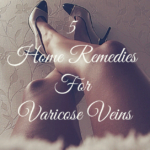 5 Home Remedies For Varicose Veins