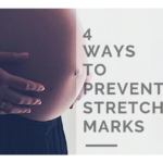 4 Ways To Prevent Stretch Marks