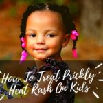 How To Treat Prickly Heat Rash On Kids